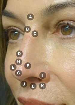 Surface points on nose