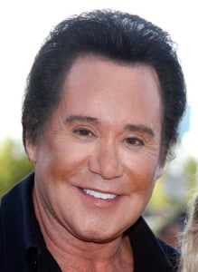 Wayne Newton after an overaggressive upper blepharoplasty. He probably would've been best served by a subtle brow lift alone