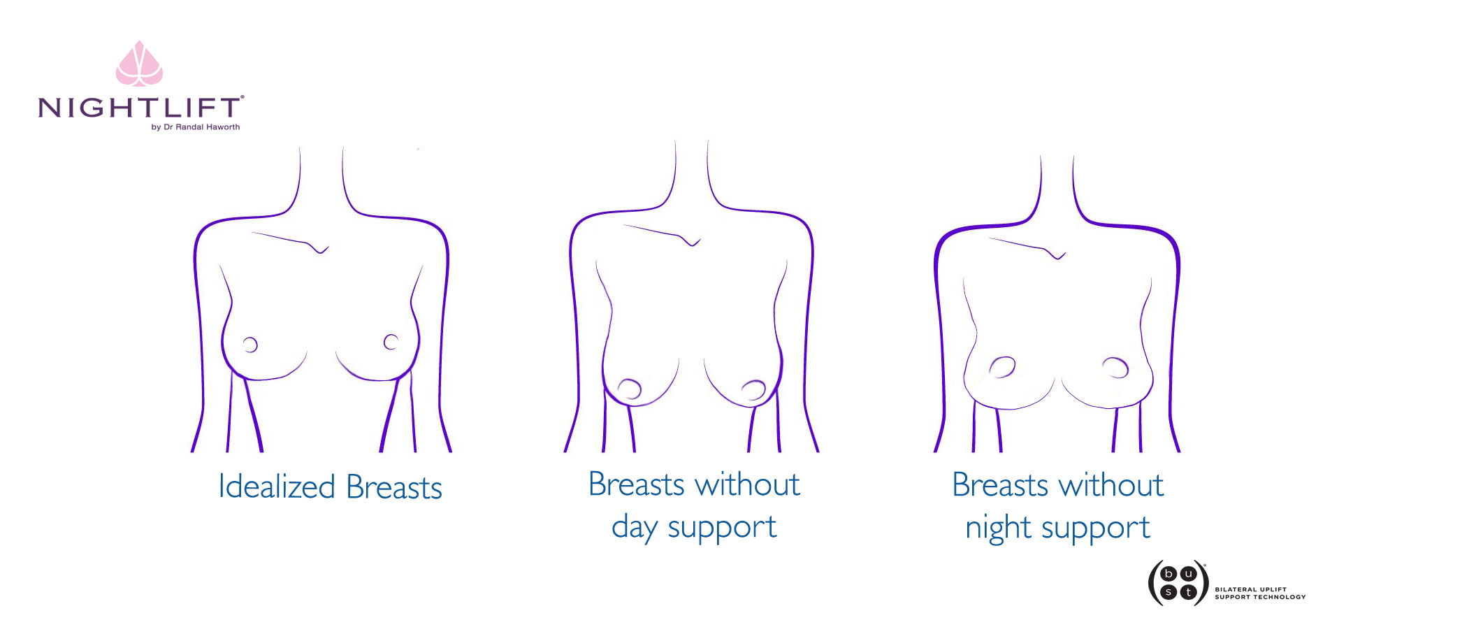 Breasts without bras