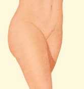 Beverly Hills liposuction procedure