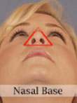 Nasal base