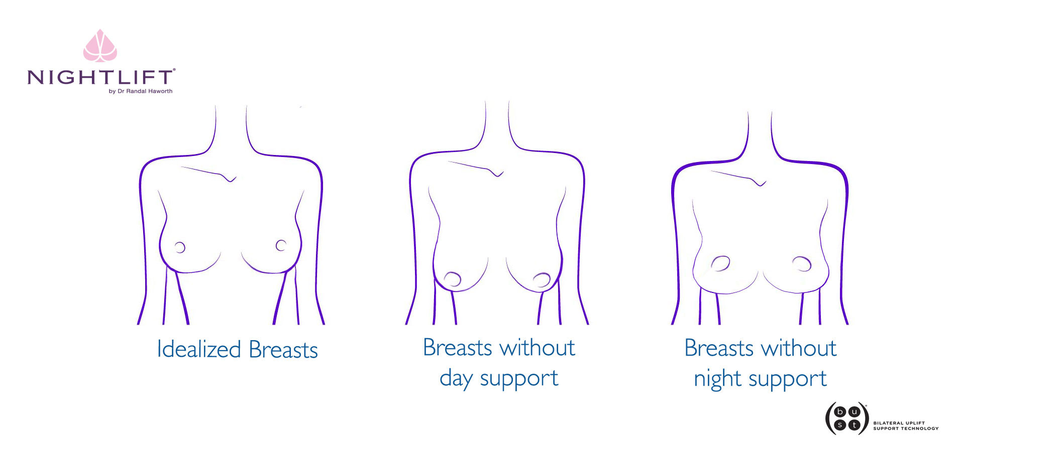 Can I Go Without a Bra After Breast Lift?