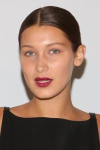 Bella Hadid with nasal deformities after closed rhinoplasty