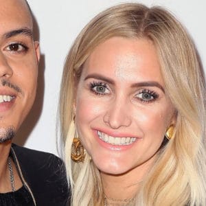 Ashlee Simpson with nasal deformities after closed rhinoplasty