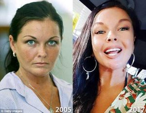 Schapelle Corby Before and After