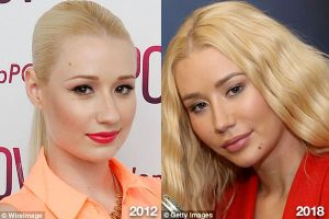 Iggy Azalea