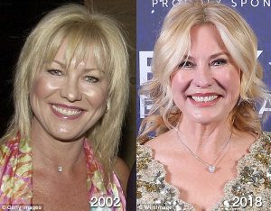 Kerri-Anne Kennerley