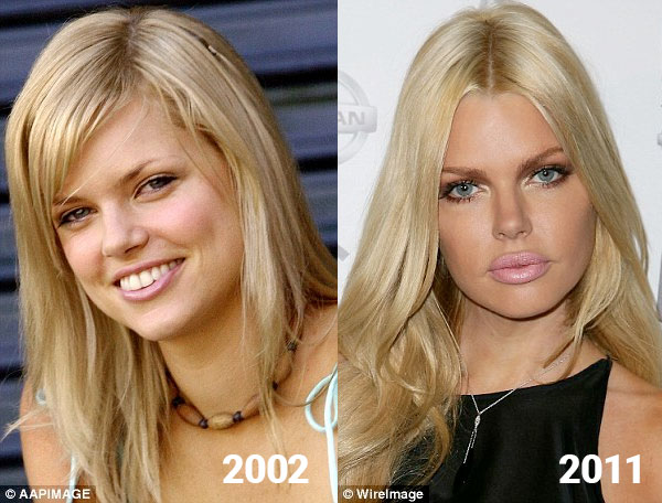 Sophie Monk’s physical transformation.