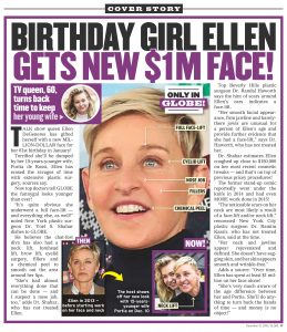 The Globe on Ellen Degeneres plastic surgery